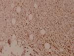 Phospho-MDM2 (Ser166) Antibody in Immunohistochemistry (Paraffin) (IHC (P))