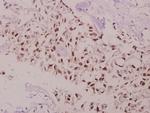 Phospho-Bcl-2 (Thr69) Antibody in Immunohistochemistry (Paraffin) (IHC (P))