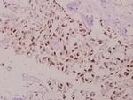 Phospho-Bcl-2 (Thr69) Antibody in Immunohistochemistry (Paraffin) (IHC (P))