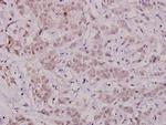 Phospho-Bcl-X (Thr47) Antibody in Immunohistochemistry (Paraffin) (IHC (P))