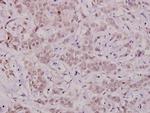 Phospho-Bcl-X (Thr47) Antibody in Immunohistochemistry (Paraffin) (IHC (P))