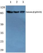 Phospho-beta Catenin (Tyr654) Antibody in Western Blot (WB)