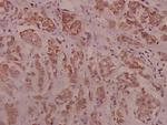 Phospho-IRS1 (Ser794) Antibody in Immunohistochemistry (Paraffin) (IHC (P))