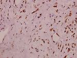 Phospho-RyR2 (Ser2808) Antibody in Immunohistochemistry (Paraffin) (IHC (P))