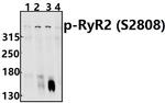 Phospho-RyR2 (Ser2808) Antibody in Western Blot (WB)