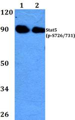 Phospho-STAT5 alpha/beta (Ser726, Ser731) Antibody in Western Blot (WB)