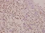 Phospho-SMAD1 (Ser465) Antibody in Immunohistochemistry (Paraffin) (IHC (P))