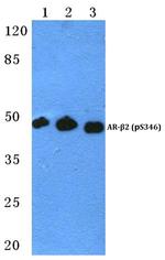 Phospho-beta-2 Adrenergic Receptor (Ser346) Antibody in Western Blot (WB)