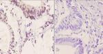 Phospho-ATF2 (Ser498) Antibody in Immunohistochemistry (Paraffin) (IHC (P))