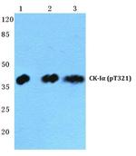 Phospho-CK1 alpha (Thr321) Antibody in Western Blot (WB)