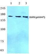 Phospho-EGFR (Ser1047) Antibody in Western Blot (WB)