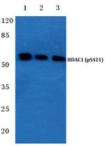 Phospho-HDAC1 (Ser421) Antibody in Western Blot (WB)