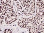 Phospho-FOXO3A (Ser253) Antibody in Immunohistochemistry (Paraffin) (IHC (P))