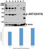 Phospho-AKT2 (Ser474) Antibody in Western Blot (WB)