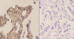 Phospho-ABL1/ABL2 (Tyr393, Tyr439) Antibody in Immunohistochemistry (Paraffin) (IHC (P))