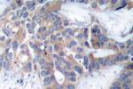 Phospho-MEK1/MEK2 (Ser218, Ser222) Antibody in Immunohistochemistry (Paraffin) (IHC (P))