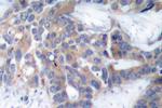 Phospho-MEK1/MEK2 (Ser218, Ser222) Antibody in Immunohistochemistry (Paraffin) (IHC (P))