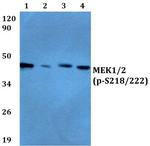 Phospho-MEK1/MEK2 (Ser218, Ser222) Antibody in Western Blot (WB)