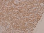 Phospho-MEK1/MEK2 (Ser222, Ser226) Antibody in Immunohistochemistry (Paraffin) (IHC (P))