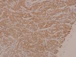 Phospho-MEK1/MEK2 (Ser222, Ser226) Antibody in Immunohistochemistry (Paraffin) (IHC (P))