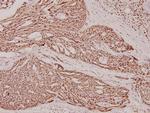 Phospho-beta Catenin (Ser37) Antibody in Immunohistochemistry (Paraffin) (IHC (P))