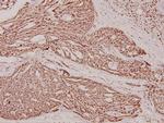 Phospho-beta Catenin (Ser37) Antibody in Immunohistochemistry (Paraffin) (IHC (P))