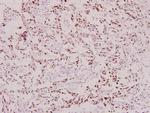 Phospho-BRCA1 (Ser1423) Antibody in Immunohistochemistry (Paraffin) (IHC (P))