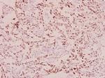 Phospho-BRCA1 (Ser1423) Antibody in Immunohistochemistry (Paraffin) (IHC (P))