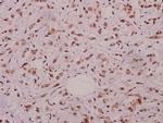 Phospho-JNK1/JNK2/JNK3 (Thr183) Antibody in Immunohistochemistry (Paraffin) (IHC (P))