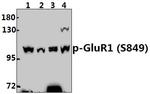 Phospho-GluR1 (Ser849) Antibody in Western Blot (WB)