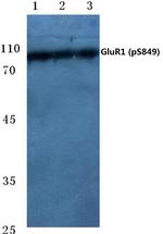 Phospho-GluR1 (Ser849) Antibody in Western Blot (WB)