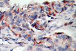 Phospho-JAK2 (Tyr221) Antibody in Immunohistochemistry (Paraffin) (IHC (P))