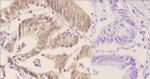 Phospho-p70 S6 Kinase (Thr421) Antibody in Immunohistochemistry (Paraffin) (IHC (P))