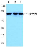 Phospho-p70 S6 Kinase (Thr421) Antibody in Western Blot (WB)