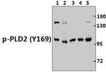 Phospho-PLD2 (Tyr169) Antibody in Western Blot (WB)