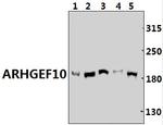 ARHGEF10 Antibody in Western Blot (WB)