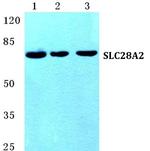 SLC28A2 Antibody in Western Blot (WB)