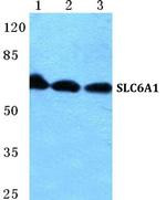 SLC6A1 Antibody in Western Blot (WB)