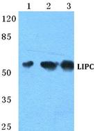 LIPC Antibody in Western Blot (WB)