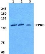 ITPKB Antibody in Western Blot (WB)