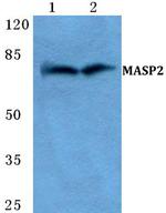 MASP2 Antibody in Western Blot (WB)