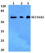 SLC16A2 Antibody in Western Blot (WB)