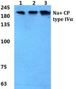 SCN4A Antibody in Western Blot (WB)