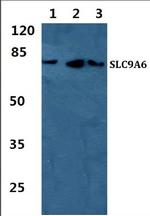 SLC9A6 Antibody in Western Blot (WB)