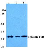 PEX11B Antibody in Western Blot (WB)