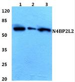 N4BP2L2 Antibody in Western Blot (WB)