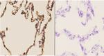 CHML Antibody in Immunohistochemistry (Paraffin) (IHC (P))