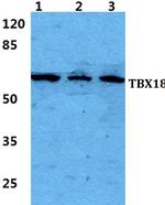 TBX18 Antibody in Western Blot (WB)