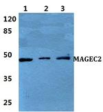 MAGEC2 Antibody in Western Blot (WB)