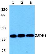 PTGR2 Antibody in Western Blot (WB)